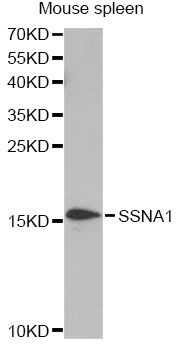 SSNA1 Antibody - Western blot analysis of extracts of mouse spleen, using SSNA1 antibody at 1:1000 dilution. The secondary antibody used was an HRP Goat Anti-Rabbit IgG (H+L) at 1:10000 dilution. Lysates were loaded 25ug per lane and 3% nonfat dry milk in TBST was used for blocking. An ECL Kit was used for detection and the exposure time was 90s.