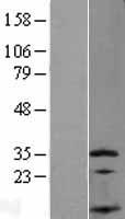 SSNA1 Protein - Western validation with an anti-DDK antibody * L: Control HEK293 lysate R: Over-expression lysate