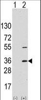 SSR1 Antibody - Western blot of SSR1 (arrow) using rabbit SSR1 Antibody. 293 cell lysates (2 ug/lane) either nontransfected (Lane 1) or transiently transfected with the SSR1 gene (Lane 2) (Origene Technologies).