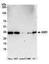 SSR1 Antibody - Detection of human and mouse SSR1 by western blot. Samples: Whole cell lysate (10 µg) from HeLa, HEK293T, Jurkat, mouse TCMK-1, and mouse NIH 3T3 cells prepared using NETN lysis buffer. Antibody: Affinity purified rabbit anti-SSR1 antibody used for WB at 0.4 µg/ml. Detection: Chemiluminescence with an exposure time of 3 minutes.