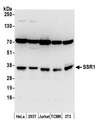 SSR1 Antibody - Detection of human and mouse SSR1 by western blot. Samples: Whole cell lysate (50 µg) from HeLa, HEK293T, Jurkat, mouse TCMK-1, and mouse NIH 3T3 cells prepared using NETN lysis buffer. Antibody: Affinity purified rabbit anti-SSR1 antibody used for WB at 0.4 µg/ml. Detection: Chemiluminescence with an exposure time of 30 seconds.