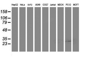 SSR1 Antibody - Western blot of extracts (35 ug) from 9 different cell lines by using anti-SSR1 monoclonal antibody (HepG2: human; HeLa: human; SVT2: mouse; A549: human; COS7: monkey; Jurkat: human; MDCK: canine; PC12: rat; MCF7: human).