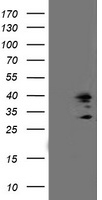 SSR1 Antibody - HEK293T cells were transfected with the pCMV6-ENTRY control (Left lane) or pCMV6-ENTRY SSR1 (Right lane) cDNA for 48 hrs and lysed. Equivalent amounts of cell lysates (5 ug per lane) were separated by SDS-PAGE and immunoblotted with anti-SSR1.