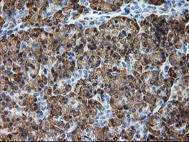 SSR1 Antibody - IHC of paraffin-embedded Human pancreas tissue using anti-SSR1 mouse monoclonal antibody.