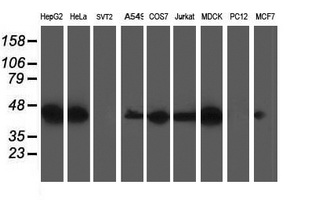SSR1 Antibody - Western blot of extracts (35 ug) from 9 different cell lines by using anti-SSR1 monoclonal antibody.