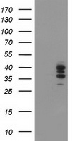 SSR1 Antibody - HEK293T cells were transfected with the pCMV6-ENTRY control (Left lane) or pCMV6-ENTRY SSR1 (Right lane) cDNA for 48 hrs and lysed. Equivalent amounts of cell lysates (5 ug per lane) were separated by SDS-PAGE and immunoblotted with anti-SSR1.
