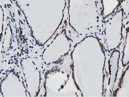 SSR1 Antibody - IHC of paraffin-embedded Human thyroid tissue using anti-SSR1 mouse monoclonal antibody.