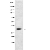 SSR1 Antibody - Western blot analysis SSR1 using Jurkat whole cells lysates