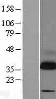 SSR1 Protein - Western validation with an anti-DDK antibody * L: Control HEK293 lysate R: Over-expression lysate