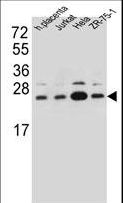 SSR2 Antibody - SSR2 Antibody western blot of human placenta tissue and Jurkat,HeLa,ZR-75-1 cell line lysates (35 ug/lane). The SSR2 antibody detected the SSR2 protein (arrow).