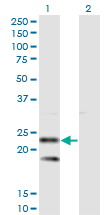 SSR2 Antibody - Western Blot analysis of SSR2 expression in transfected 293T cell line by SSR2 monoclonal antibody (M01), clone 4C1.Lane 1: SSR2 transfected lysate (Predicted MW: 20.5 KDa).Lane 2: Non-transfected lysate.