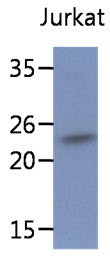 SSR2 Antibody - Western Blot: The lysate of Jurkat (40 ug) were resolved by SDS-PAGE, transferred to PVDF membrane and probed with anti-human SSR2 antibody (1:500). Proteins were visualized using a goat anti-mouse secondary antibody conjugated to HRP and an ECL detection system.
