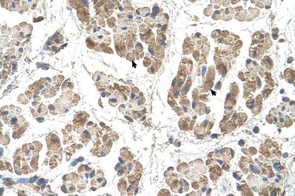 SSR2 Antibody - SSR2 antibody ARP45429_T100-NP_003136-SSR2(signal sequence receptor, beta (translocon-associated protein beta)) Antibody IHC of formalin-fixed, paraffin-embedded human Muscle. Positive label: Skeletal muscle cells indicated with arrows. Antibody concentration 4-8 ug/ml. Magnification 400X.  This image was taken for the unconjugated form of this product. Other forms have not been tested.