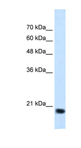 SSR2 Antibody - SSR2 antibody ARP45429_T100-NP_003136-SSR2(signal sequence receptor, beta (translocon-associated protein beta)) Antibody Western blot of Jurkat lysate.  This image was taken for the unconjugated form of this product. Other forms have not been tested.