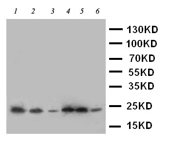 SSR3 / TRAP-Gamma Antibody - WB of SSR3 / TRAP-Gamma antibody. Lane 1: Rat Liver Tissue Lysate. Lane 2: Rat Spleen Tissue Lysate. Lane 3: A431 Cell Lysate. Lane 4: HELA Cell Lysate. Lane 5: U87 Cell Lysate. Lane 6: SMMC Cell Lysate.