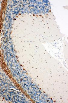 SSR3 / TRAP-Gamma Antibody - SSR3 / TRAP-Gamma antibody. IHC(P): Rat Brain Tissue.