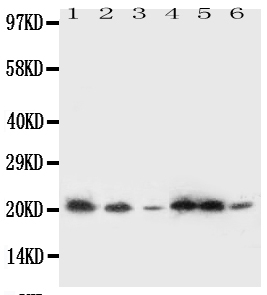 SSR3 / TRAP-Gamma Antibody - Anti-SSR3 antibody, Western blotting All lanes: Anti SSR3 at 0.5ug/ml Lane 1: Rat Liver Tissue Lysate at 50ugLane 2: Rat Spleen Tissue Lysate at 50ugLane 3: A431 Whole Cell Lysate at 40ugLane 4: HELA Whole Cell Lysate at 40ugLane 5: U87 Whole Cell Lysate at 40ugLane 6: SMMC Whole Cell Lysate at 40ugPredicted bind size: 21KD Observed bind size: 21KD