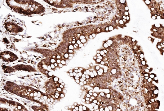 SSR3 / TRAP-Gamma Antibody - IHC analysis of SSR3 using anti-SSR3 antibody. SSR3 was detected in paraffin-embedded section of rat intestine tissues. Heat mediated antigen retrieval was performed in citrate buffer (pH6, epitope retrieval solution) for 20 mins. The tissue section was blocked with 10% goat serum. The tissue section was then incubated with 1µg/ml rabbit anti-SSR3 Antibody overnight at 4°C. Biotinylated goat anti-rabbit IgG was used as secondary antibody and incubated for 30 minutes at 37°C. The tissue section was developed using Strepavidin-Biotin-Complex (SABC) with DAB as the chromogen.