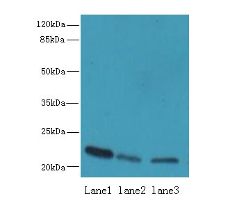 SSR3 / TRAP-Gamma Antibody - Western blot. All lanes: SSR3 antibody at 10 ug/ml. Lane 1: HeLa whole cell lysate. Lane 2: U87 whole cell lysate. Lane 3: A431 whole cell lysate. Secondary Goat polyclonal to Rabbit IgG at 1:10000 dilution. Predicted band size: 21 kDa. Observed band size: 21 kDa.