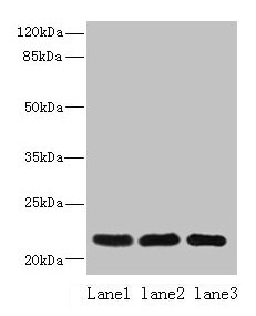 SSR3 / TRAP-Gamma Antibody - Western blot All lanes: SSR3 antibody at 10µg/ml Lane 1: Hela whole cell lysate Lane 2: U87 whole cell lysate Lane 3: A431 whole cell lysate Secondary Goat polyclonal to rabbit IgG at 1/10000 dilution Predicted band size: 22, 23 kDa Observed band size: 22 kDa