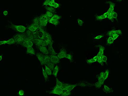 SSR3 / TRAP-Gamma Antibody - Immunofluorescence staining of SSR3 in A431 cells. Cells were fixed with 4% PFA, permeabilzed with 0.1% Triton X-100 in PBS, blocked with 10% serum, and incubated with rabbit anti-Human SSR3 polyclonal antibody (dilution ratio 1:200) at 4°C overnight. Then cells were stained with the Alexa Fluor 488-conjugated Goat Anti-rabbit IgG secondary antibody (green). Positive staining was localized to Cytoplasm.