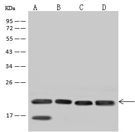 SSR3 / TRAP-Gamma Antibody - Anti-SSR3 rabbit polyclonal antibody at 1:500 dilution. Lane A: A431 Whole Cell Lysate. Lane B: HeLa Whole Cell Lysate. Lane C: U87 MG Whole Cell Lysate. Lane D: U-251 MG Whole Cell Lysate. Lysates/proteins at 30 ug per lane. Secondary: Goat Anti-Rabbit IgG (H+L)/HRP at 1/10000 dilution. Developed using the ECL technique. Performed under reducing conditions. Predicted band size: 21 kDa. Observed band size: 20 kDa.