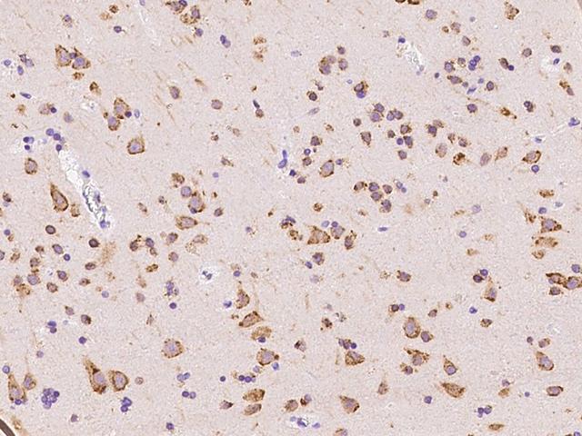 SSR3 / TRAP-Gamma Antibody - Immunochemical staining of human SSR3 in human brain with rabbit polyclonal antibody at 1:100 dilution, formalin-fixed paraffin embedded sections.