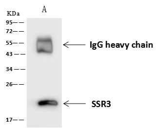 SSR3 / TRAP-Gamma Antibody - SSR3 was immunoprecipitated using: Lane A: 0.5 mg A431 Whole Cell Lysate. 4 uL anti-SSR3 rabbit polyclonal antibody and 60 ug of Immunomagnetic beads Protein A/G. Primary antibody: Anti-SSR3 rabbit polyclonal antibody, at 1:100 dilution. Secondary antibody: Goat Anti-Rabbit IgG (H+L)/HRP at 1/10000 dilution. Developed using the ECL technique. Performed under reducing conditions. Predicted band size: 21 kDa. Observed band size: 21 kDa.