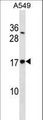 SSR4 Antibody - SSR4 Antibody western blot of A549 cell line lysates (35 ug/lane). The SSR4 antibody detected the SSR4 protein (arrow).