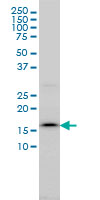 SSR4 Antibody - SSR4 monoclonal antibody (M01), clone 2D3 Western Blot analysis of SSR4 expression in C32.