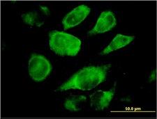 SSR4 Antibody - Immunofluorescence of monoclonal antibody to SSR4 on HeLa cell. [antibody concentration 10 ug/ml]