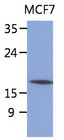 SSR4 Antibody - The lysate of MCF7 (40ug) were resolved by SDS-PAGE, transferred to PVDF membrane and probed with anti-human SSR4 antibody (1:1000). Proteins were visualized using a goat anti-mouse secondary antibody conjugated to HRP and an ECL detection system.