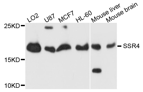 SSR4 Antibody - Western blot analysis of extracts of HeLa cells.