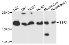 SSR4 Antibody - Western blot analysis of extracts of HeLa cells.