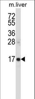 SSSCA1 / p27 Antibody - SSSCA1 Antibody (N-term ) western blot of mouse liver tissue lysates (35 ug/lane). The SSSCA1 antibody detected the SSSCA1 protein (arrow).