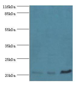 SSSCA1 / p27 Antibody - Western blot. All lanes: Sjoegren syndrome/scleroderma autoantigen 1 antibody at 2 ug/ml. Lane 1: A549 whole cell lysate Lane 2: MCF-7 whole cell lysate Lane 3: 293T whole cell lysate. Secondary antibody: goat polyclonal to rabbit at 1:10000 dilution.  This image was taken for the unconjugated form of this product. Other forms have not been tested.