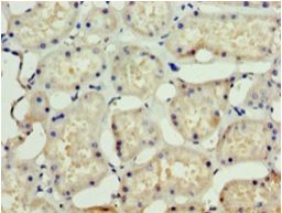 SSSCA1 / p27 Antibody - Immunohistochemistry of paraffin-embedded human kidney using antibody at 1:100 dilution.  This image was taken for the unconjugated form of this product. Other forms have not been tested.