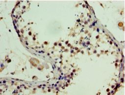 SSSCA1 / p27 Antibody - Immunohistochemistry of paraffin-embedded human testis using antibody at 1: 100 dilution.  This image was taken for the unconjugated form of this product. Other forms have not been tested.