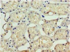SSSCA1 / p27 Antibody - Immunohistochemistry of paraffin-embedded human kidney using antibody at 1:100 dilution.  This image was taken for the unconjugated form of this product. Other forms have not been tested.
