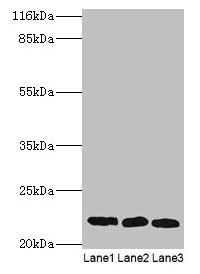 SSSCA1 / p27 Antibody - Western blot All lanes: Sjoegren syndrome/scleroderma autoantigen 1 antibody at 2µg/ml Lane 1: A549 whole cell lysate Lane 2: MCF-7 whole cell lysate Lane 3: 293T whole cell lysate Secondary Goat polyclonal to rabbit IgG at 1/10000 dilution Predicted band size: 21 kDa Observed band size: 21 kDa