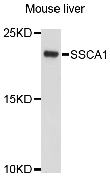 SSSCA1 / p27 Antibody - Western blot analysis of extracts of mouse liver, using SSSCA1 antibody at 1:1000 dilution. The secondary antibody used was an HRP Goat Anti-Rabbit IgG (H+L) at 1:10000 dilution. Lysates were loaded 25ug per lane and 3% nonfat dry milk in TBST was used for blocking. An ECL Kit was used for detection and the exposure time was 10s.