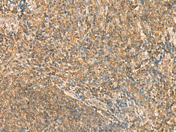 SSSCA1 / p27 Antibody - Immunohistochemistry of paraffin-embedded Human tonsil tissue  using SSSCA1 Polyclonal Antibody at dilution of 1:50(×200)