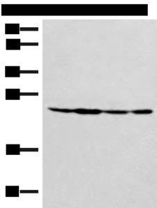 SSSCA1 / p27 Antibody - Western blot analysis of Hela 231 and A549 cell Mouse liver tissue lysates  using SSSCA1 Polyclonal Antibody at dilution of 1:400