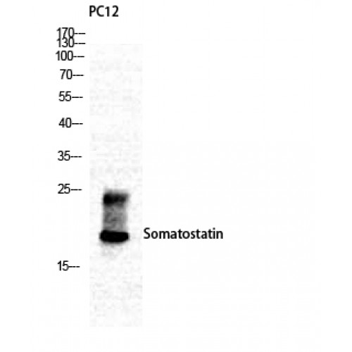 SST / Somatostatin Antibody - Western blot of Somatostatin antibody