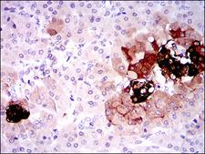SST / Somatostatin Antibody - IHC of paraffin-embedded pancreas tissues using SST mouse monoclonal antibody with DAB staining.