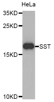 SST / Somatostatin Antibody - Western blot analysis of extracts of HeLa cells.