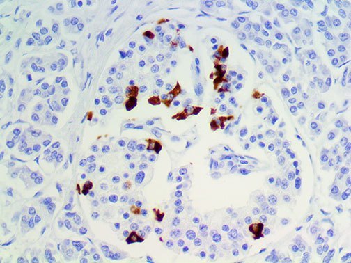 SST / Somatostatin Antibody - IHC of Somatostatin on a FFPE Pancreas Tissue