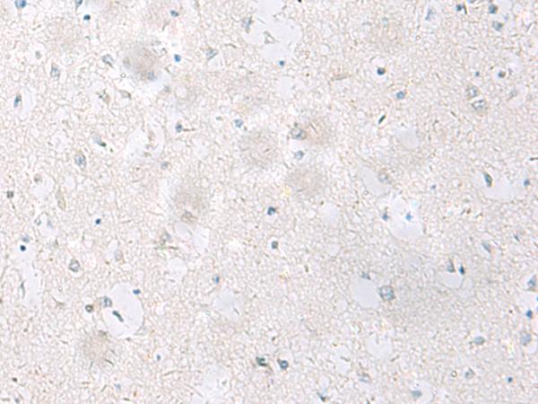 SST / Somatostatin Antibody - Immunohistochemistry of paraffin-embedded Human brain tissue  using SST Polyclonal Antibody at dilution of 1:60(×200)