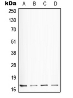 SST / Somatostatin Antibody - Western blot analysis of Somatostatin expression in HepG2 (A); NIH3T3 (B); mouse lung (C); H4 (D) whole cell lysates.