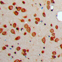 SST / Somatostatin Antibody - Immunohistochemical analysis of Somatostatin staining in human brain formalin fixed paraffin embedded tissue section. The section was pre-treated using heat mediated antigen retrieval with sodium citrate buffer (pH 6.0). The section was then incubated with the antibody at room temperature and detected using an HRP conjugated compact polymer system. DAB was used as the chromogen. The section was then counterstained with hematoxylin and mounted with DPX.